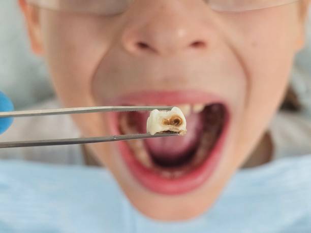 Best Walk-In Emergency Dentist in Maysville, GA
